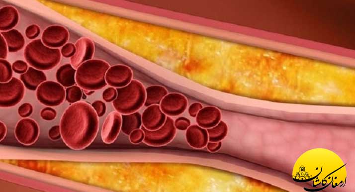 عرقیات گیاهی برای کاهش تری گلیسیرید عرقیات گیاهی برای کاهش تری گلیسیرید