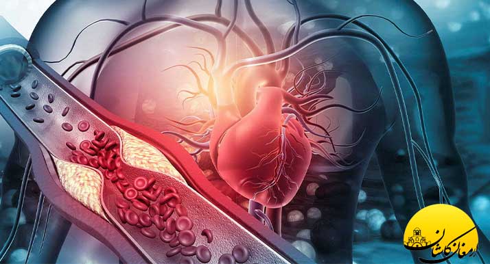 عرقیات گیاهی برای درمان چربی خون